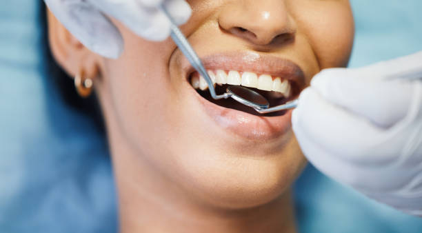 Best Dentist for Dental Trauma  in Rangely, CO
